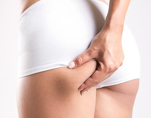 Alisar celulitis adiposa con LPG en Centro de Peluquería y Estética Montse Prados en Motril (Granada)